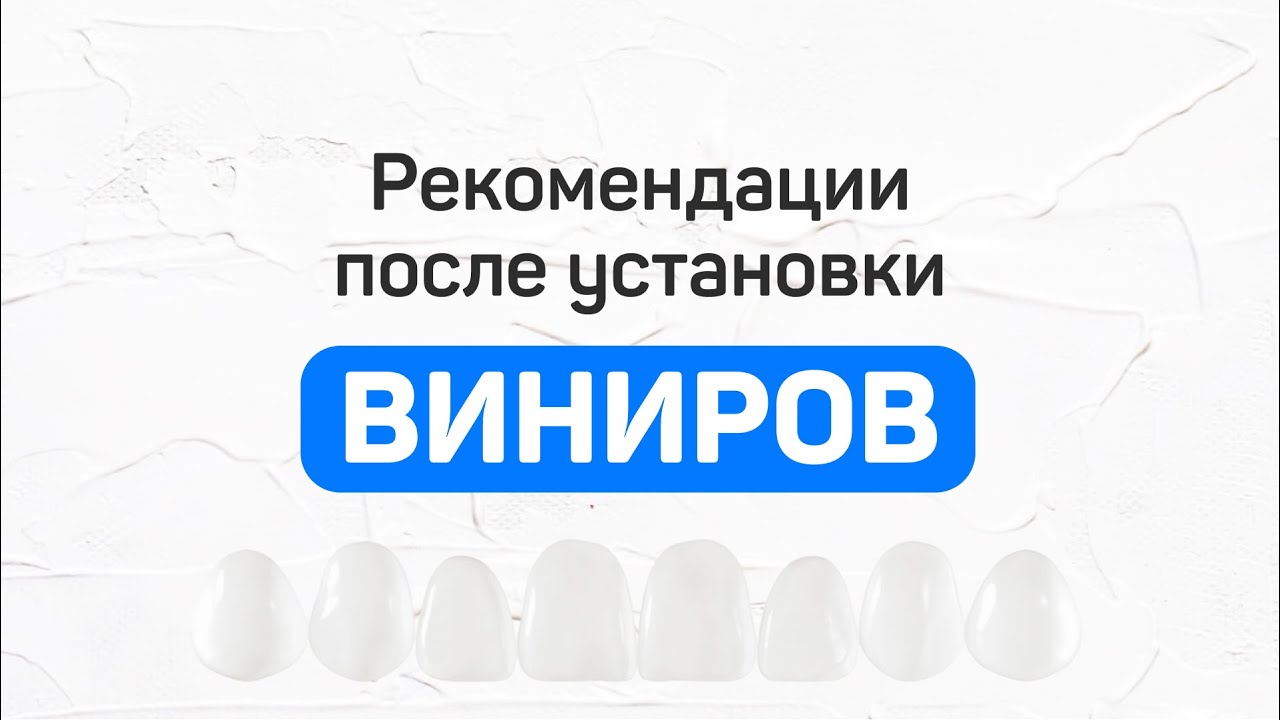 Как ухаживать за винирами после установки