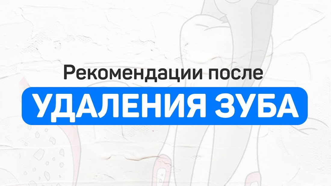 Шарифов Шариф Робертович рассказывает когда можно есть после удаления зуба и чем обрабатывать область удаления