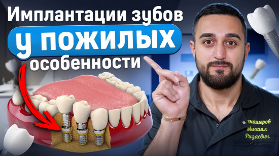 Костная пластика перед имплантацией