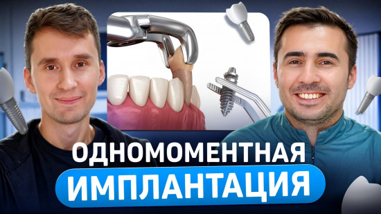 Одномоментная имплантация