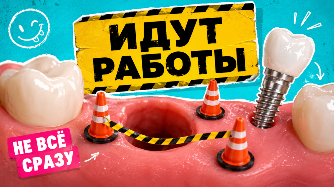 Удалили зуб. Когда уже можно ставить имплант?