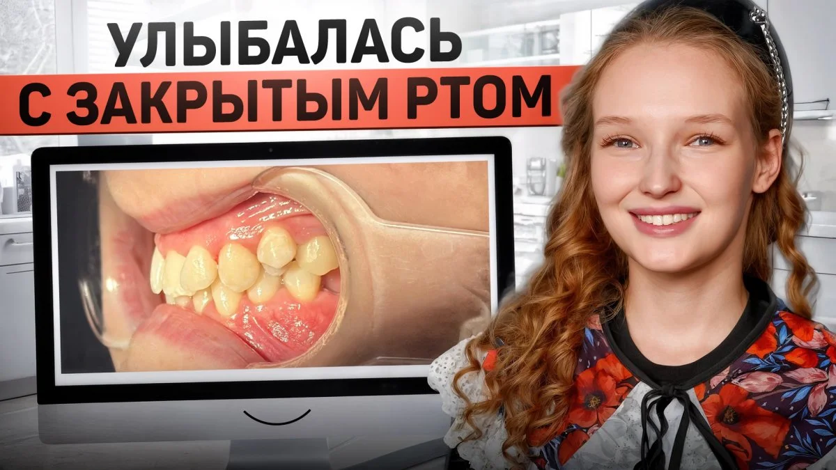 Видео