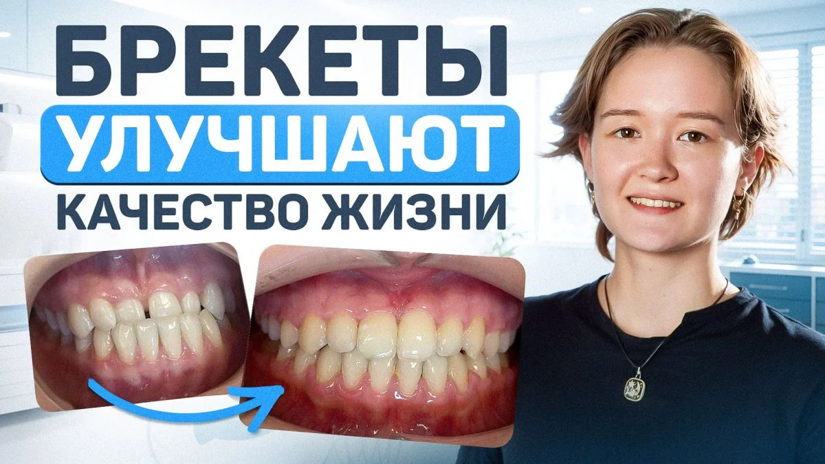 Видео